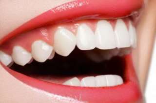 أسباب التهاب اللثة وطرق علاجها