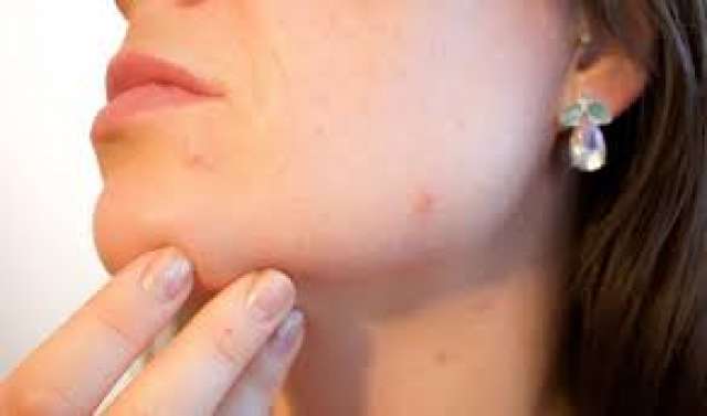 تعرف على دور النظام الغذائي في اكتشاف حساسية الطعام