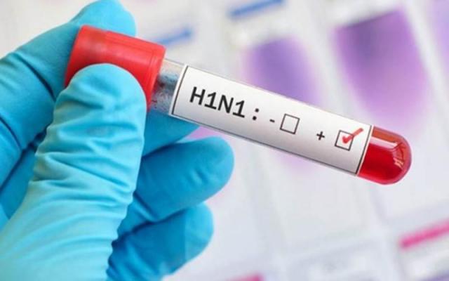 الإنفلونزا الموسمية H1N1
