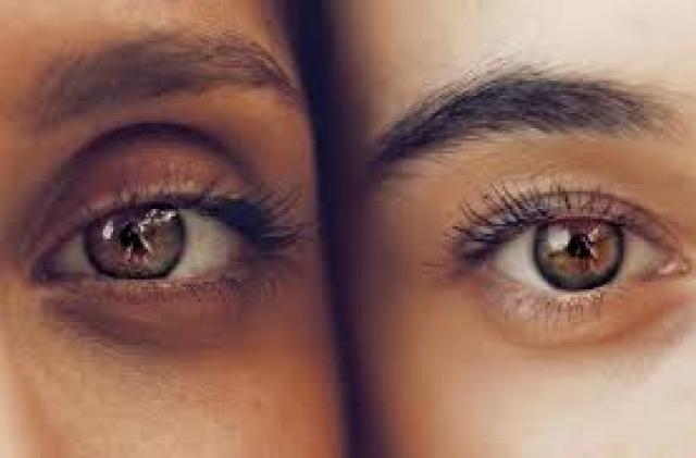 علاج الهالات السوداء