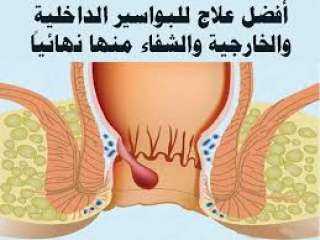  5 طرق منزلية فعالة لعلاج...