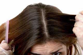 طرق طبيعية للتخلص من قشرة...