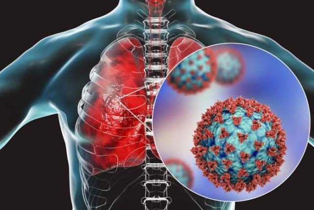 دراسة: مركب نباتي يمكن أن يقلل من خطر إصابة الرئة من ”كوفيد” بنسبة 29٪