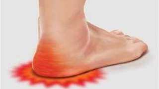 ننشر اسباب وأعراض النقرس عند...