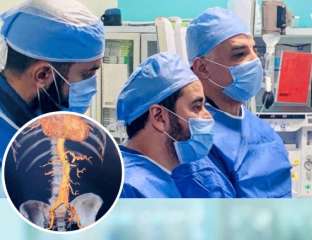 نجاح علاج تمدد الشريان الأورطى...