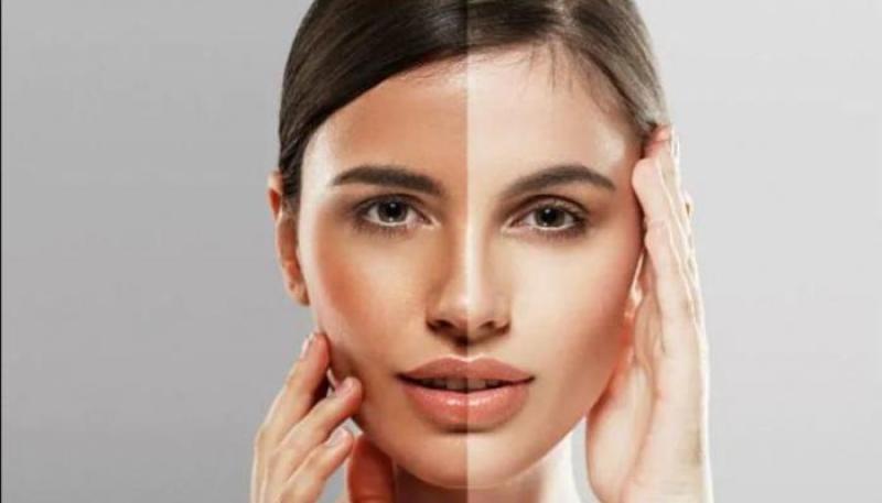 أفضل خلطات طبيعية لتبييض الوجه