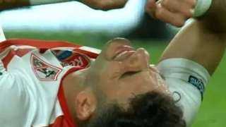 الزمالك، أشعة جديدة على قدم...