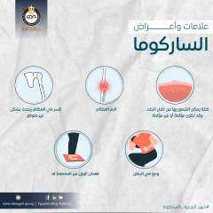 ما هي الساركوما وما أعراضها...