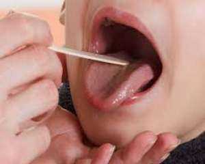 علاج التهاب الحلق عند الأطفال...