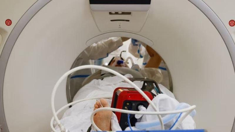 تحذير صحي.. الإفراط في استخدام أشعة CT Scan قد يسبب أكثر من 100 ألف حالة سرطان مستقبلاً
