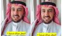 استشاري تغذية يحذر من إهمال...