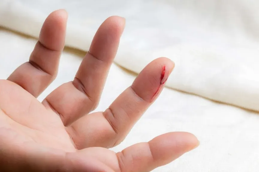تفسير حلم الجرح في الرجل للرجل والمرأة لابن سيرين في اليد اليسرى واليمنى