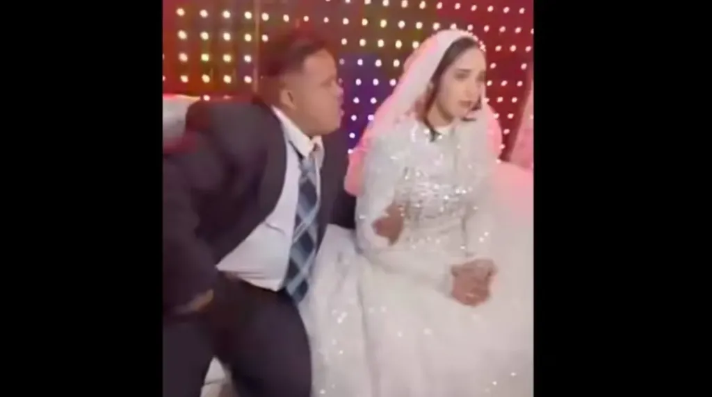 عريس متلازمة داون