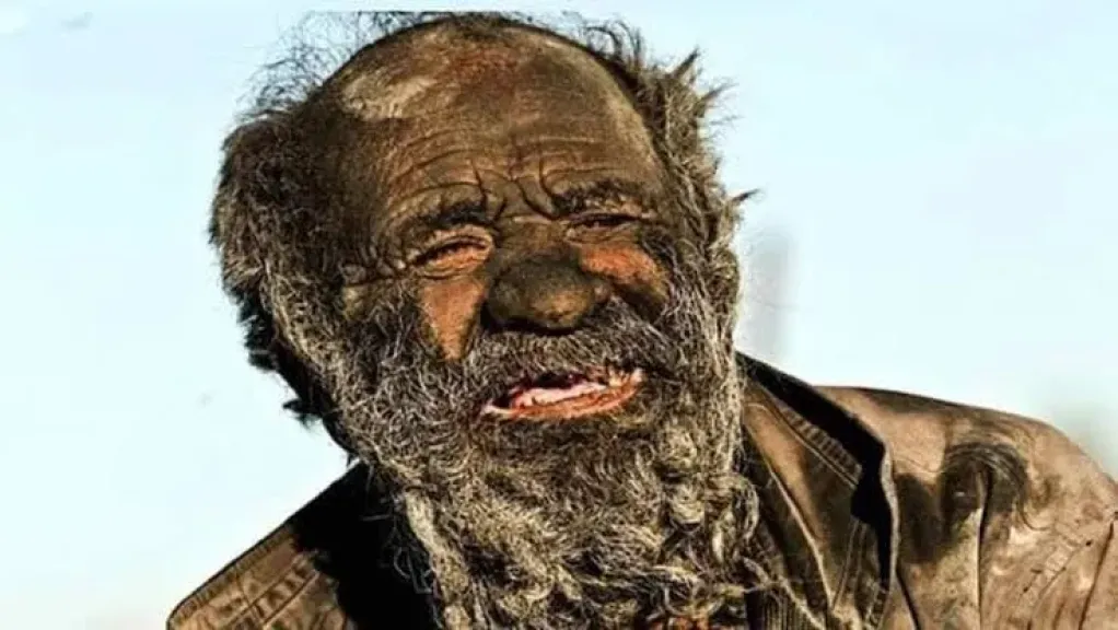 من هو اعفن انسان في العالم حاليا