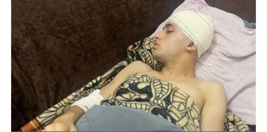 ماذا حدث؟ إحداث عاهة مستديمة لحلاق في السيدة زينب بسبب ”صوفينار”