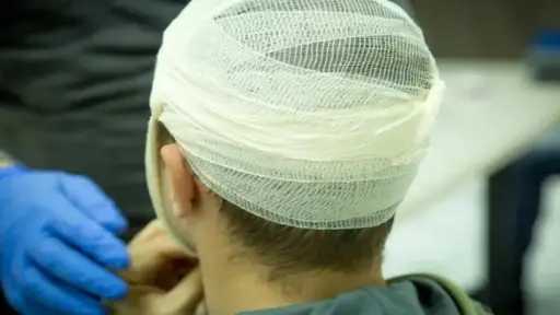 خرج من منزله فتلقى ضربة...
