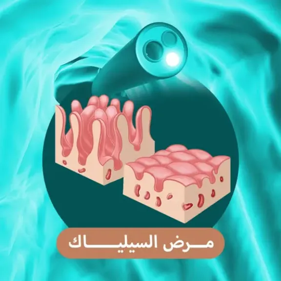 مرض السيلياك