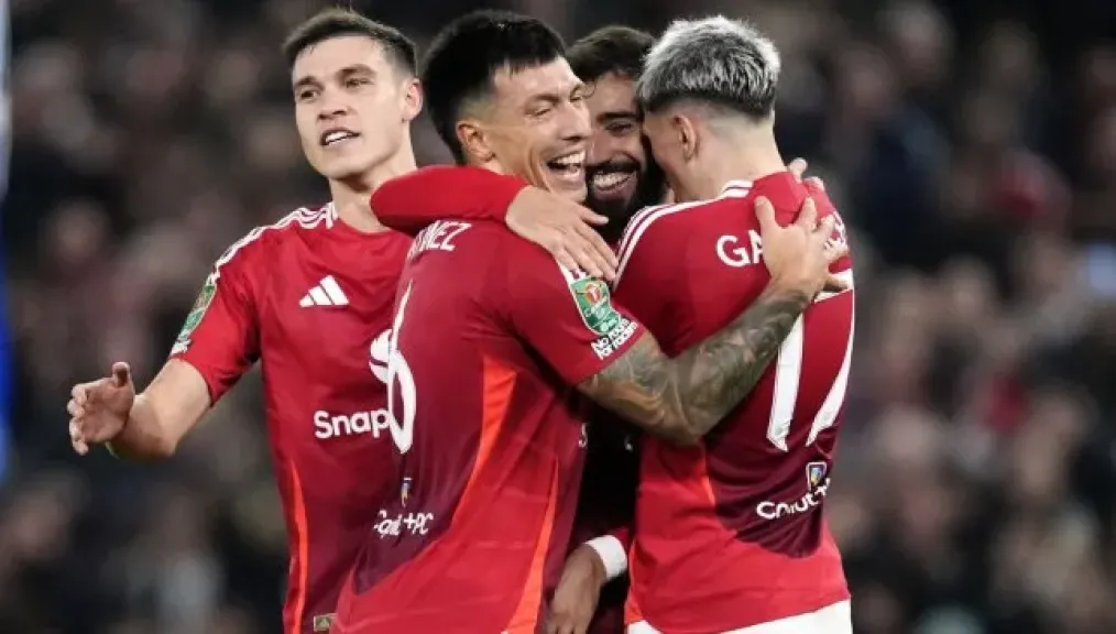 معلق مباراة مانشستر يونايتد اليوم ضد بيرنلي في الدوري الإنجليزي والقنوات الناقلة