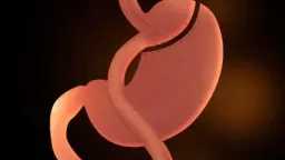 عملية تحويل المسار: الفوائد، المخاطر،...