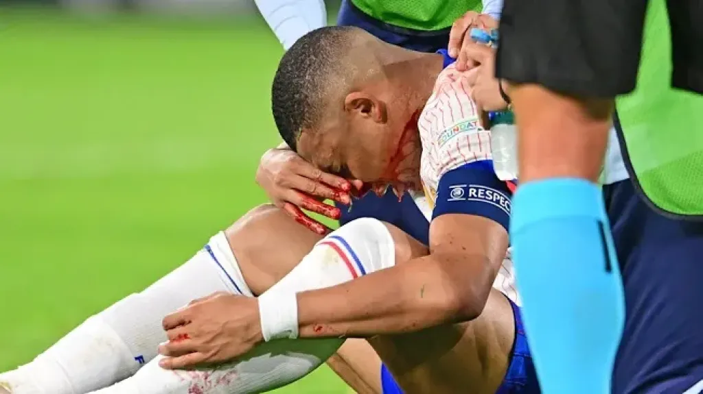 مفاجأة غير متوقعة.. إصابة مبابي تقلب موازين ريال مدريد قبل صدام بنفيكا