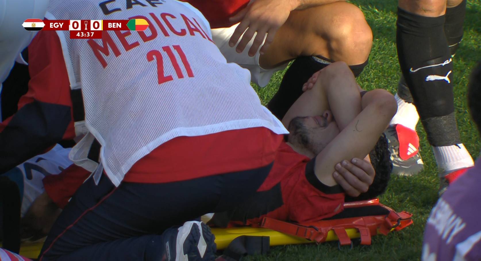 إصابة محمد حمدي 